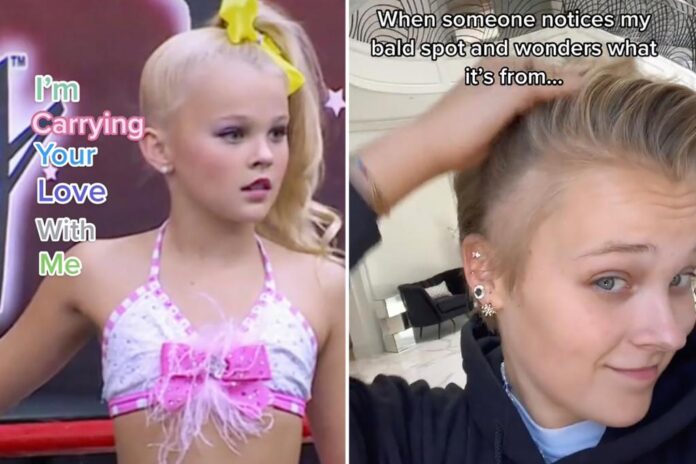 jojo siwa bald spot stress 99