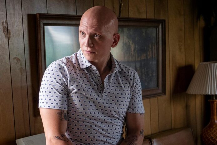 anthony carrigan alopecia